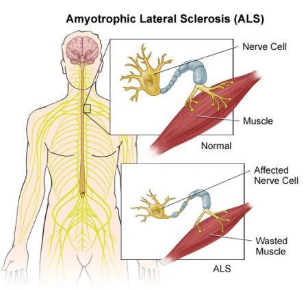 Sla