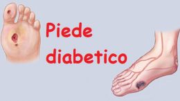 piede-diabetico11